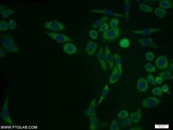 PSMA1 Rabbit anti-Human, Mouse, Rat, Polyclonal, Proteintech:Antibodies:Primary