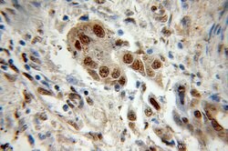 PSMA1 Rabbit anti-Human, Mouse, Rat, Polyclonal, Proteintech:Antibodies:Primary