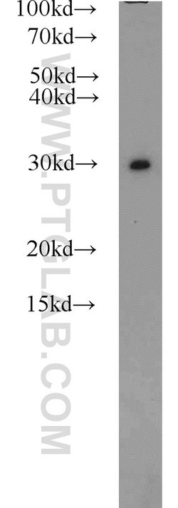 PSMA1 Rabbit anti-Human, Mouse, Rat, Polyclonal, Proteintech:Antibodies:Primary