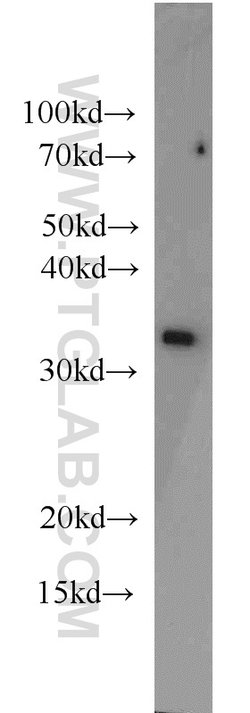 PSMA1 Rabbit anti-Human, Mouse, Rat, Polyclonal, Proteintech:Antibodies:Primary