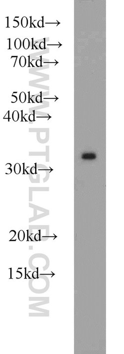 PSMA1 Rabbit anti-Human, Mouse, Rat, Polyclonal, Proteintech:Antibodies:Primary