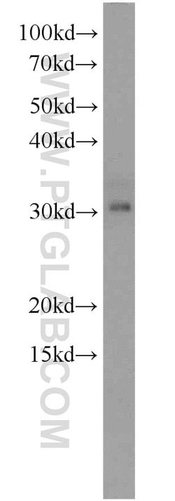 PSMA1 Rabbit anti-Human, Mouse, Rat, Polyclonal, Proteintech:Antibodies:Primary