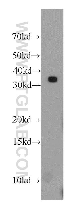 HNRNPA1 Rabbit anti-Human, Mouse, Porcine, Polyclonal, Proteintech:Antibodies:Primary