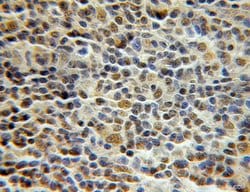 PCNP Rabbit anti-Human, Mouse, Rat, Polyclonal, Proteintech:Antibodies:Primary