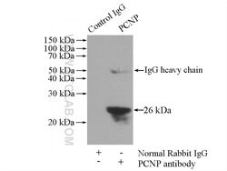 PCNP Rabbit anti-Human, Mouse, Rat, Polyclonal, Proteintech:Antibodies:Primary
