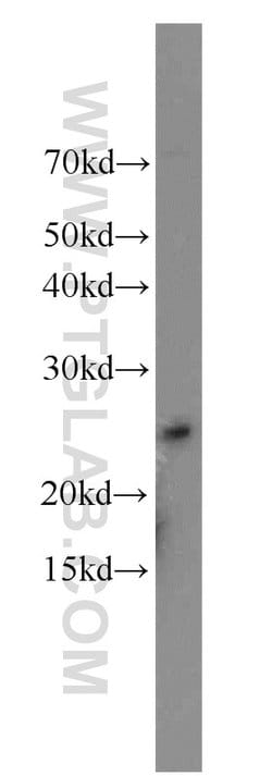 PCNP Rabbit anti-Human, Mouse, Rat, Polyclonal, Proteintech:Antibodies:Primary