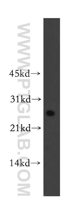 PCNP Rabbit anti-Human, Mouse, Rat, Polyclonal, Proteintech:Antibodies:Primary