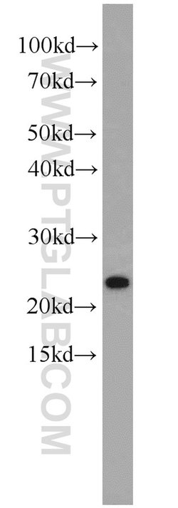 PCNP Rabbit anti-Human, Mouse, Rat, Polyclonal, Proteintech:Antibodies:Primary