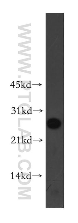 Proteintech PCNP Rabbit anti-Human, Mouse, Rat, Polyclonal, Proteintech