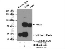 BBS2 Rabbit anti-Human, Mouse, Rat, Polyclonal, Proteintech 150 &mu;L;