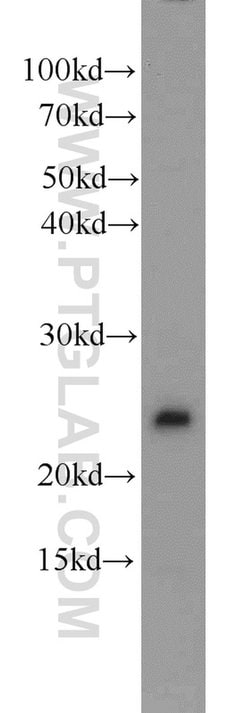 PMF1 Rabbit anti-Human, Mouse, Polyclonal, Proteintech:Antibodies:Primary