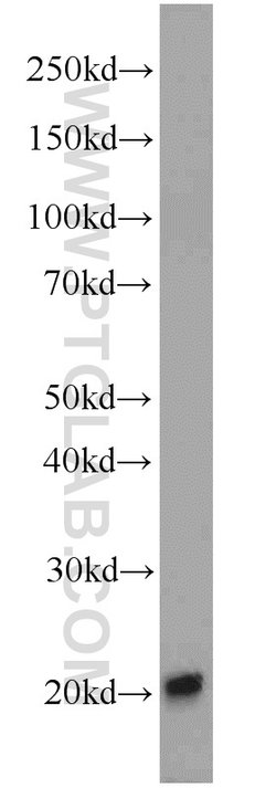 EIF1AY Rabbit anti-Human, Polyclonal, Proteintech 150 &mu;L; Unconjugated:Antibodies,