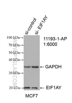EIF1AY Rabbit anti-Human, Polyclonal, Proteintech 150 &mu;L; Unconjugated:Antibodies,