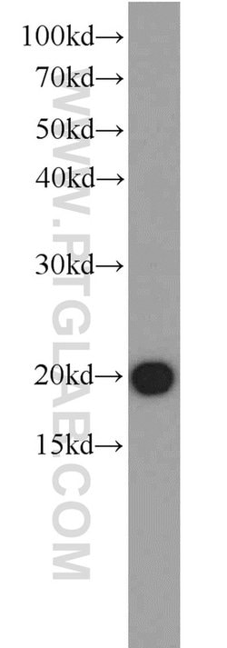 EIF1AY Rabbit anti-Human, Polyclonal, Proteintech 150 &mu;L; Unconjugated:Antibodies,