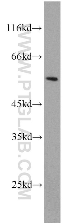 PSMC1 Rabbit anti-Human, Mouse, Rat, Polyclonal, Proteintech 20 &mu;L;