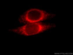 ORM2 Rabbit anti-Human, Mouse, Polyclonal, Proteintech 150 &mu;L; Unconjugated:Antibodies,