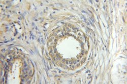 ORM2 Rabbit anti-Human, Mouse, Polyclonal, Proteintech 150 &mu;L; Unconjugated:Antibodies,