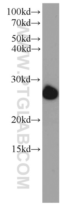 ORM2 Rabbit anti-Human, Mouse, Polyclonal, Proteintech 150 &mu;L; Unconjugated:Antibodies,