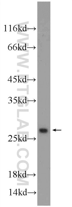 ORM2 Rabbit anti-Human, Mouse, Polyclonal, Proteintech 150 &mu;L; Unconjugated:Antibodies,