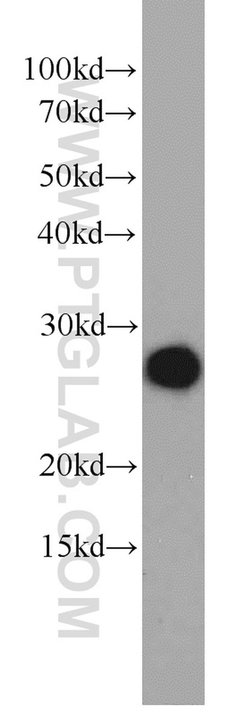 ORM2 Rabbit anti-Human, Mouse, Polyclonal, Proteintech 150 &mu;L; Unconjugated:Antibodies,