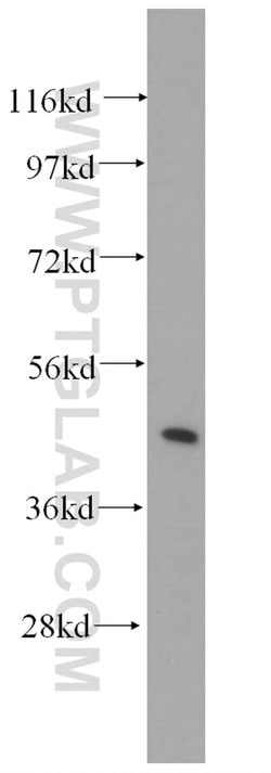 Syntaxin 16 Rabbit anti-Human, Mouse, Rat, Polyclonal, Proteintech:Antibodies:Primary