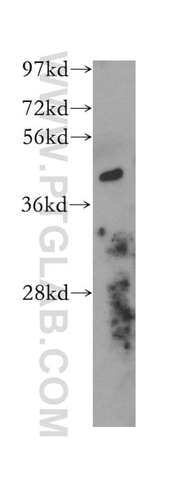 Actopaxin Rabbit anti-Human, Mouse, Rat, Polyclonal, Proteintech:Antibodies:Primary