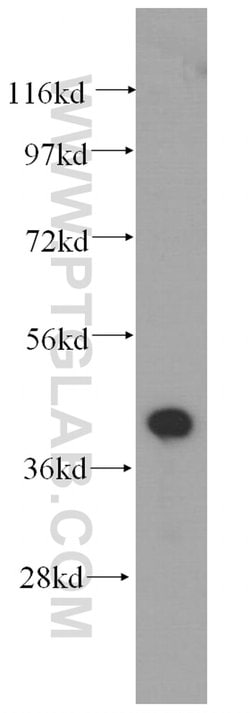 Actopaxin Rabbit anti-Human, Mouse, Rat, Polyclonal, Proteintech:Antibodies:Primary