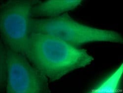 ENO1 Rabbit anti-Human, Mouse, Rat, Polyclonal, Proteintech:Antibodies:Primary