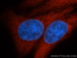ENO1 Rabbit anti-Human, Mouse, Rat, Polyclonal, Proteintech:Antibodies:Primary