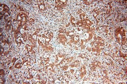 ENO1 Rabbit anti-Human, Mouse, Rat, Polyclonal, Proteintech:Antibodies:Primary