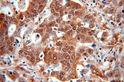 ENO1 Rabbit anti-Human, Mouse, Rat, Polyclonal, Proteintech:Antibodies:Primary