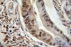 ENO1 Rabbit anti-Human, Mouse, Rat, Polyclonal, Proteintech:Antibodies:Primary