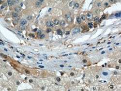 ENO1 Rabbit anti-Human, Mouse, Rat, Polyclonal, Proteintech:Antibodies:Primary