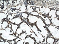 ENO1 Rabbit anti-Human, Mouse, Rat, Polyclonal, Proteintech:Antibodies:Primary