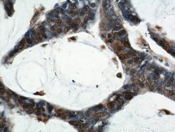 ENO1 Rabbit anti-Human, Mouse, Rat, Polyclonal, Proteintech:Antibodies:Primary