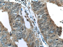 ENO1 Rabbit anti-Human, Mouse, Rat, Polyclonal, Proteintech:Antibodies:Primary