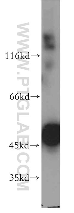 ENO1 Rabbit anti-Human, Mouse, Rat, Polyclonal, Proteintech:Antibodies:Primary