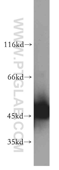 ENO1 Rabbit anti-Human, Mouse, Rat, Polyclonal, Proteintech:Antibodies:Primary