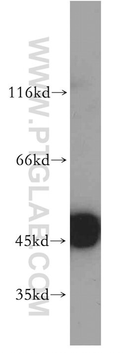 ENO1 Rabbit anti-Human, Mouse, Rat, Polyclonal, Proteintech:Antibodies:Primary