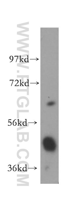 ENO1 Rabbit anti-Human, Mouse, Rat, Polyclonal, Proteintech:Antibodies:Primary
