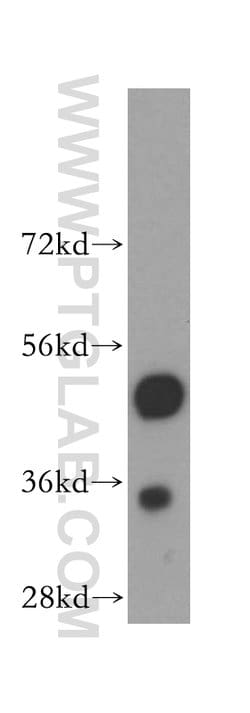 ENO1 Rabbit anti-Human, Mouse, Rat, Polyclonal, Proteintech:Antibodies:Primary