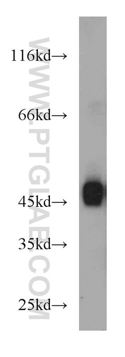 SPAM1 Rabbit anti-Human, Polyclonal, Proteintech 150 &mu;L; Unconjugated:Antibodies,