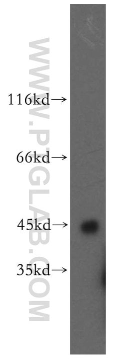 SPAM1 Rabbit anti-Human, Polyclonal, Proteintech 150 &mu;L; Unconjugated:Antibodies,