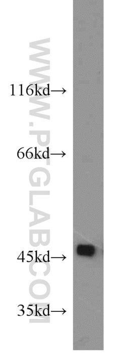SPAM1 Rabbit anti-Human, Polyclonal, Proteintech 150 &mu;L; Unconjugated:Antibodies,