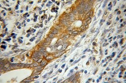 Pancreatic Lipase Rabbit anti-Human, Mouse, Rat, Polyclonal, Proteintech:Antibodies:Primary