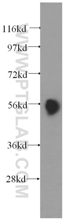 Pancreatic Lipase Rabbit anti-Human, Mouse, Rat, Polyclonal, Proteintech:Antibodies:Primary