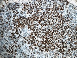 Pancreatic Lipase Rabbit anti-Human, Mouse, Rat, Polyclonal, Proteintech:Antibodies:Primary