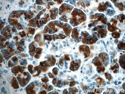 Pancreatic Lipase Rabbit anti-Human, Mouse, Rat, Polyclonal, Proteintech:Antibodies:Primary