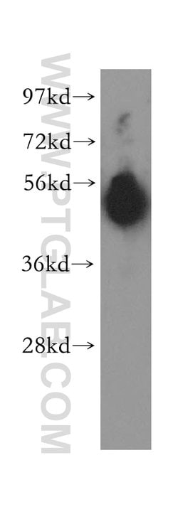 Pancreatic Lipase Rabbit anti-Human, Mouse, Rat, Polyclonal, Proteintech:Antibodies:Primary