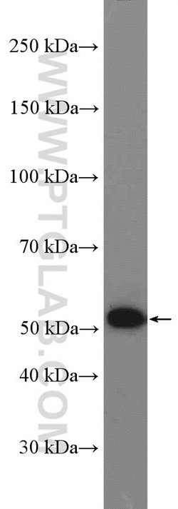Pancreatic Lipase Rabbit anti-Human, Mouse, Rat, Polyclonal, Proteintech:Antibodies:Primary